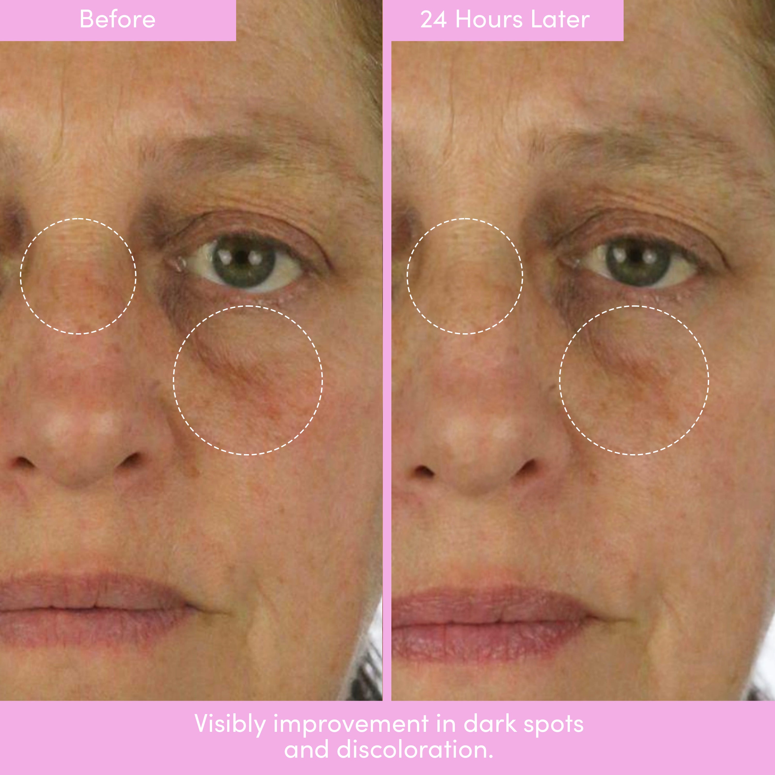 *WELCOME BUNDLE* AHA Serum, Peptide Cream & Tote + FREE SPF ($39)!