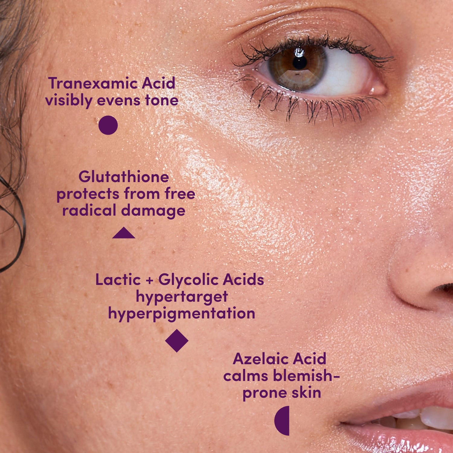 UNSPOTTED 4X® Dark Spot Correcting Serum for Hyperpigmentation