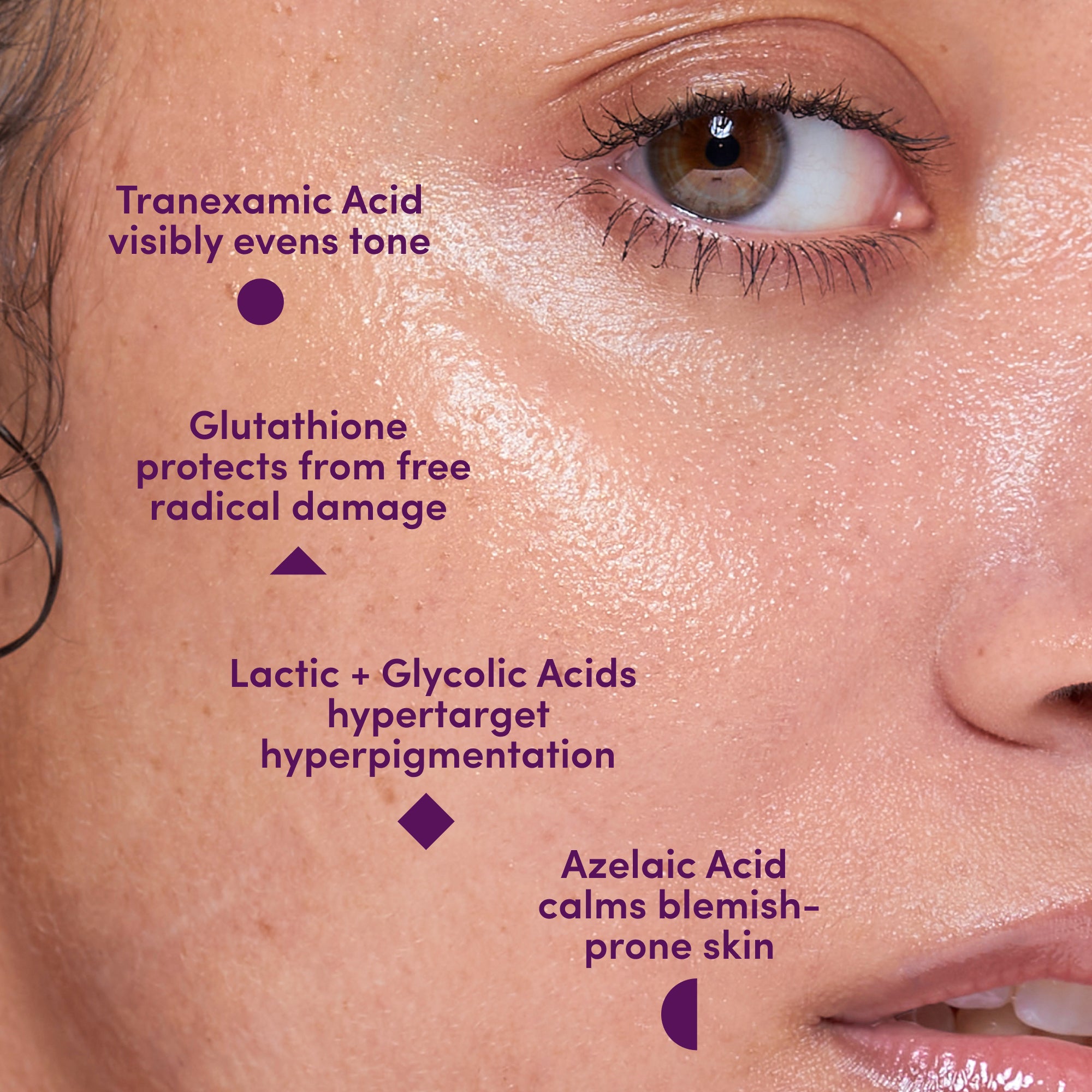 UNSPOTTED 4X® Dark Spot Correcting Serum for Hyperpigmentation