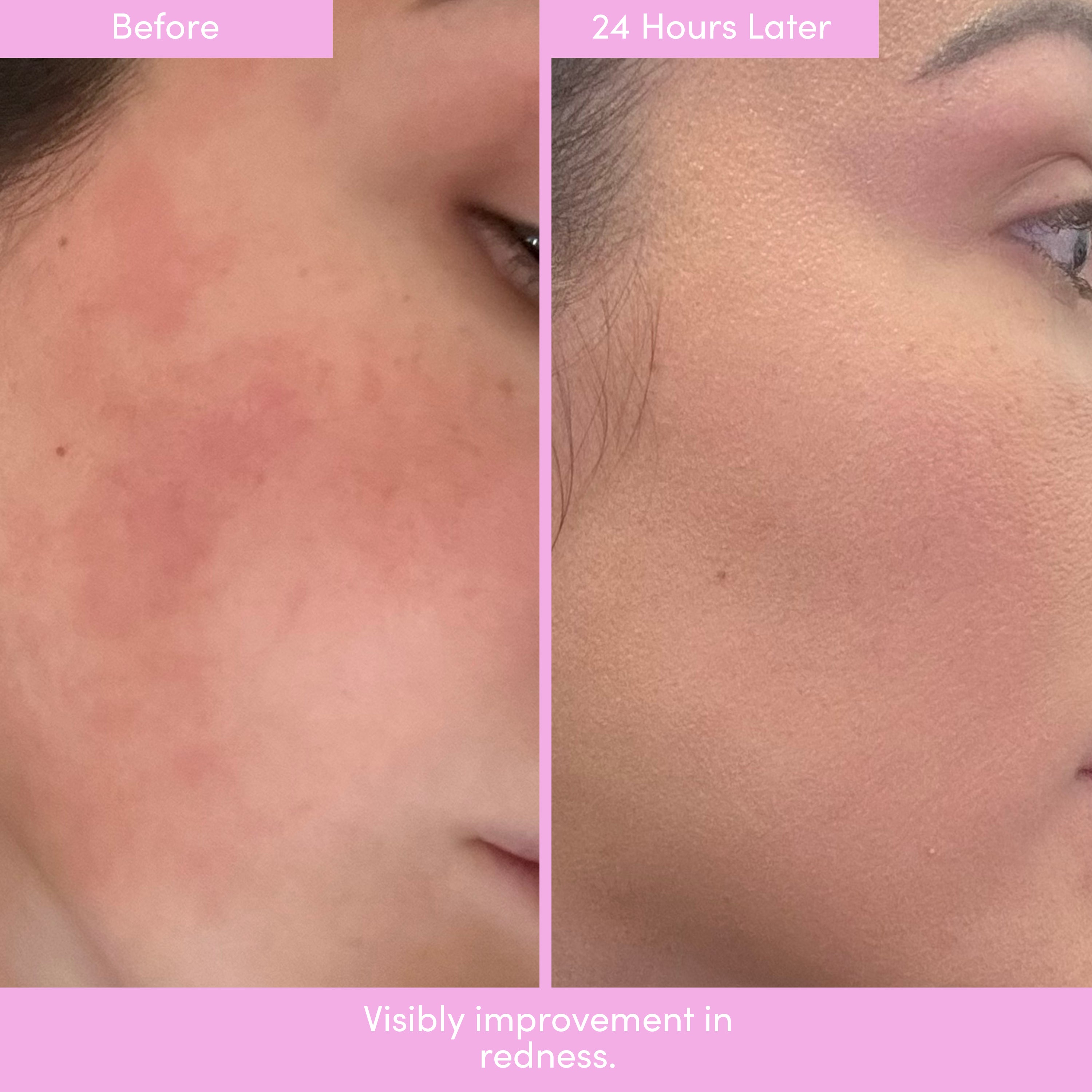 *WELCOME BUNDLE* AHA Serum, Peptide Cream & Tote + FREE SPF ($39)!