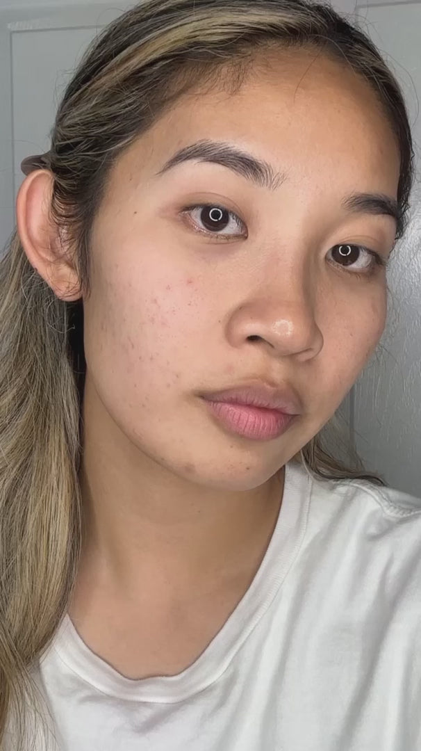 UNSPOTTED 4X® Dark Spot Correcting Serum for Hyperpigmentation