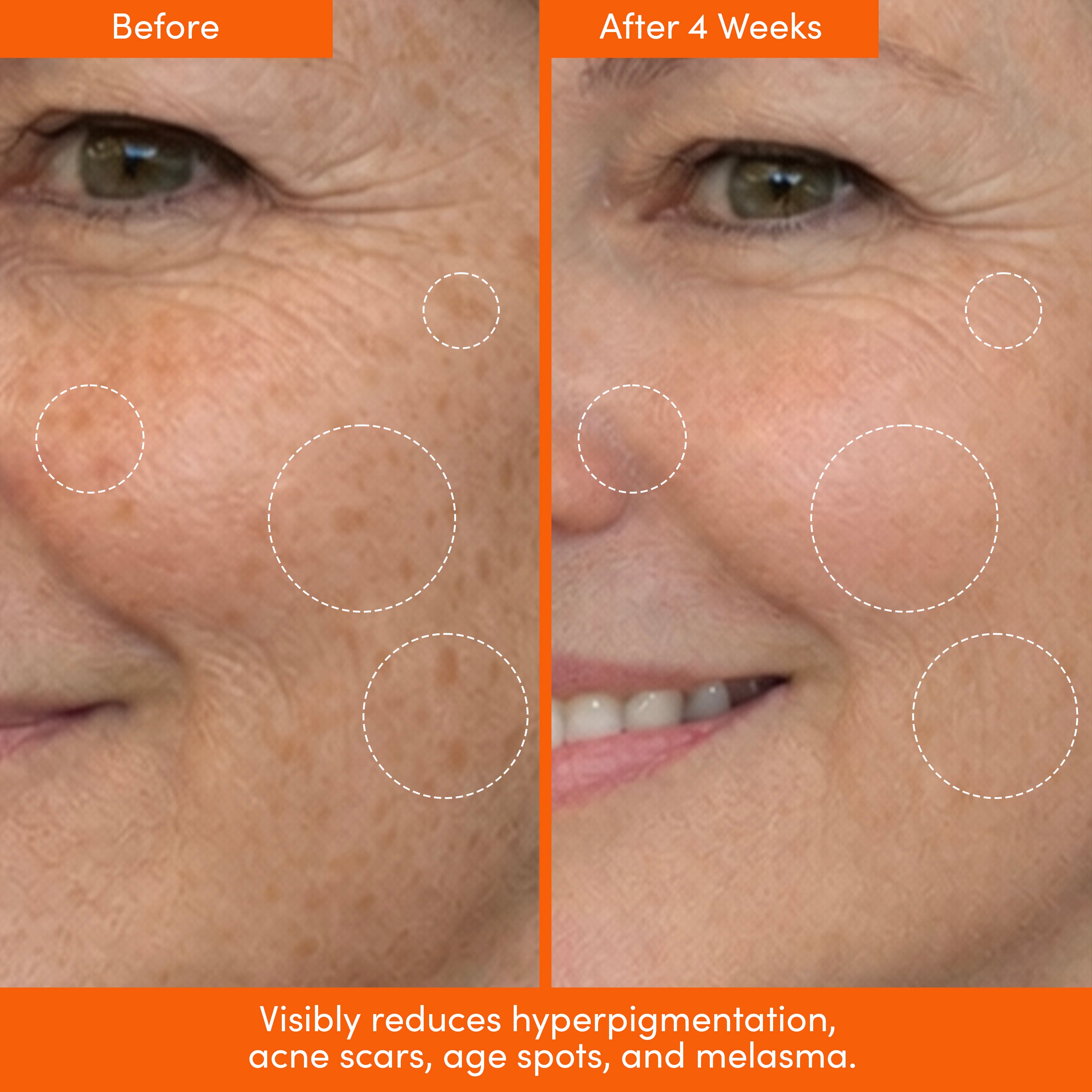 THE PLACENTA FACIAL — Dark Spot Serum + Barrier Repair Cream