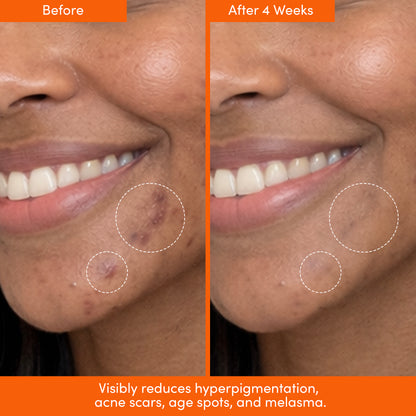 THE PLACENTA FACIAL Dark Spot Serum + Barrier Repair Cream Bundle