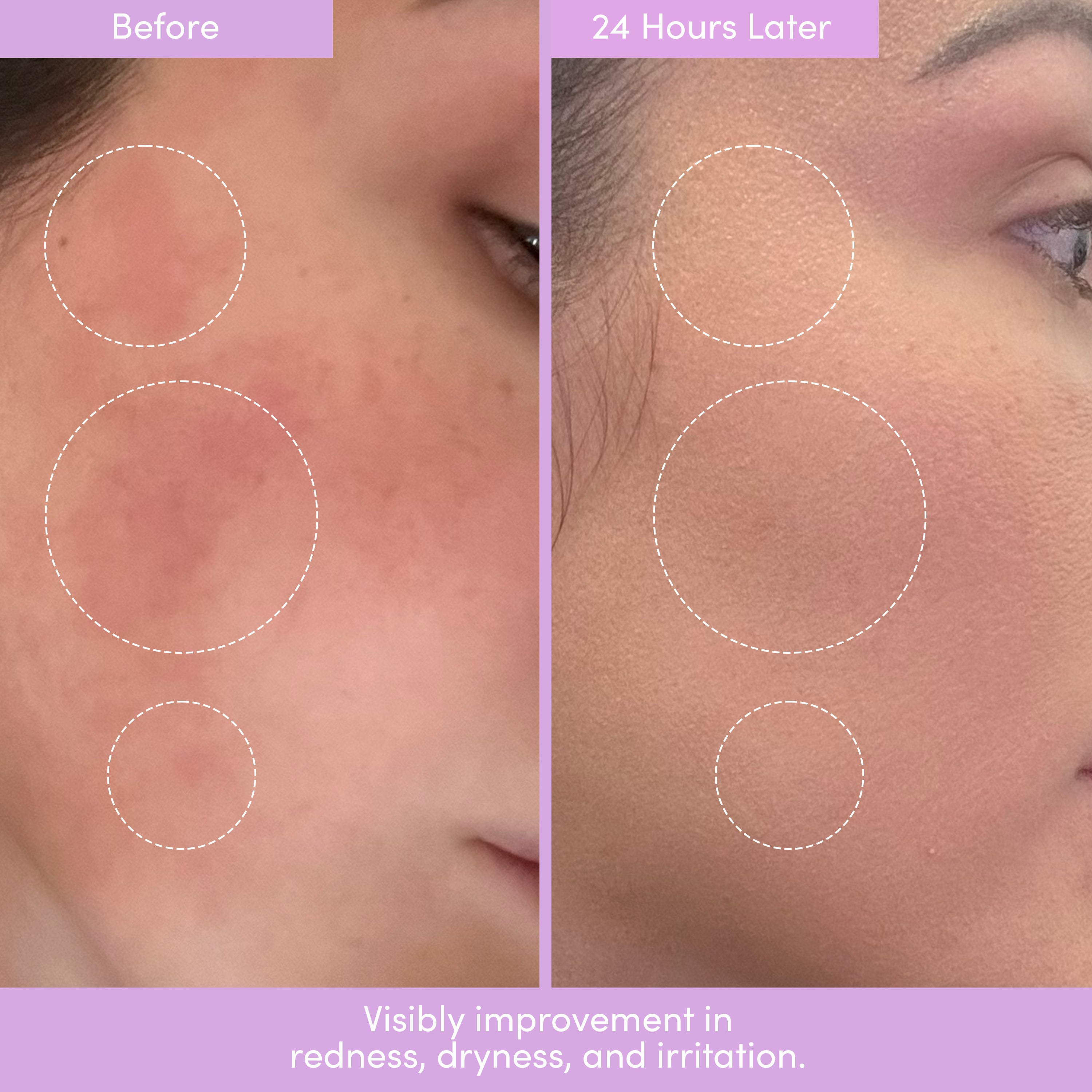 PEP TALK™ Barrier Repair (50 ML) | Peptides, Ceramides & Triple