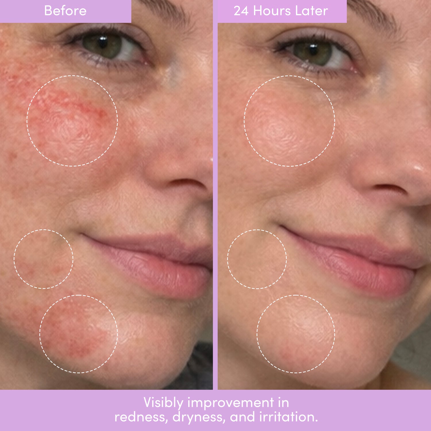 THE PLACENTA FACIAL Dark Spot Serum + Barrier Repair Cream Bundle